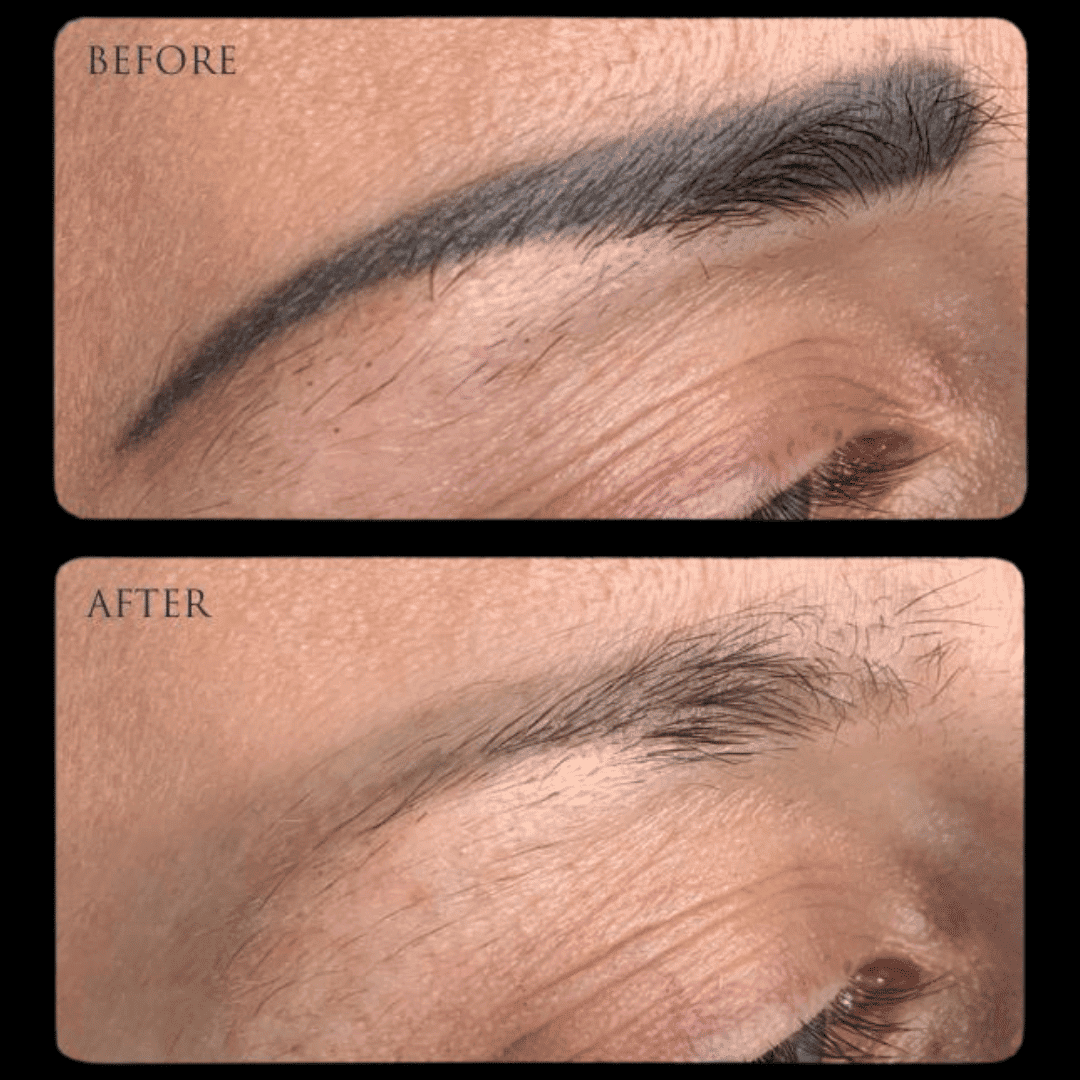 Before and after comparison of eyebrow microblading results.